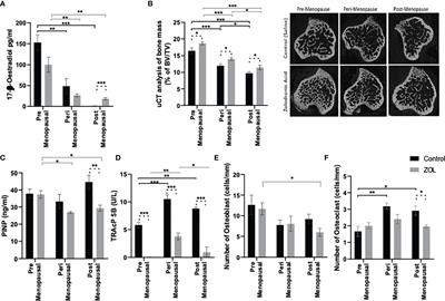 Oestradiol Contributes to Differential Antitumour Effects of Adjuvant Zoledronic Acid Observed Between Pre- and Post-Menopausal Women